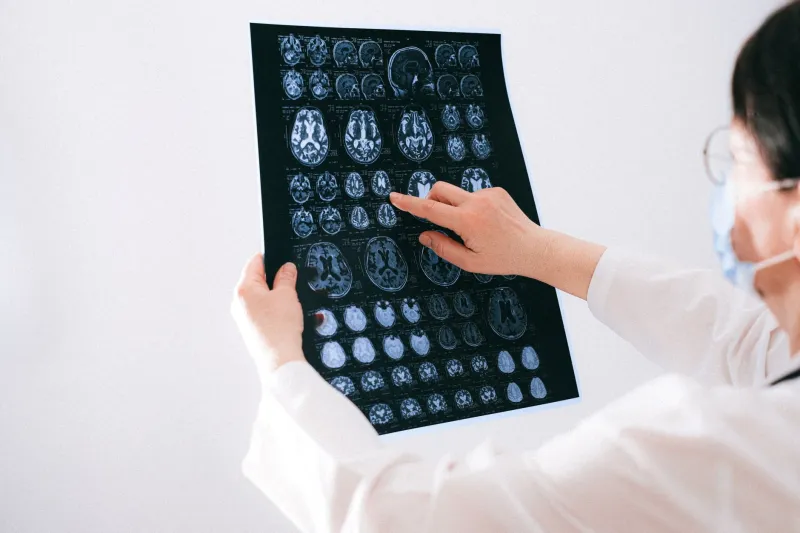 When CJD Doesn't Look Like CJD: The Diagnostic Challenge of Atypical Presentations in Newark Patients