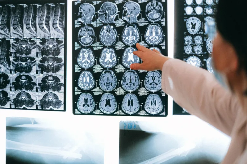 Lost in the Differential: How New Jersey Neurologists Are Failing to Catch CJD — and What You Can Do About It