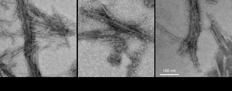 The Next Generation of CJD Detection: How Emerging Biomarker Technologies Are Changing What Newark Neurologists Can See