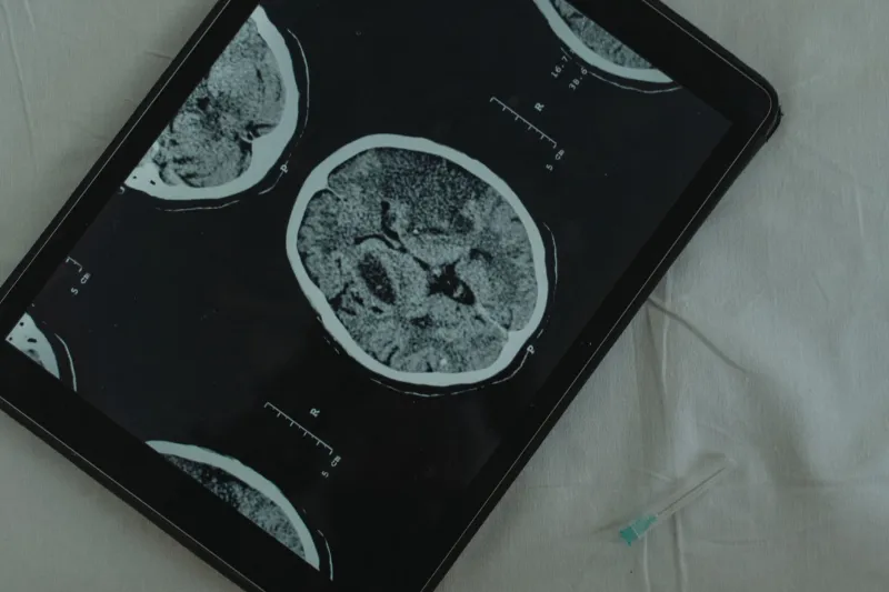 What Newark's Neurology Ecosystem Means for CJD Patients Who Live Miles Away